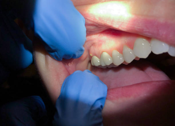 Best Broken Tooth Emergency  in Belmar, NJ